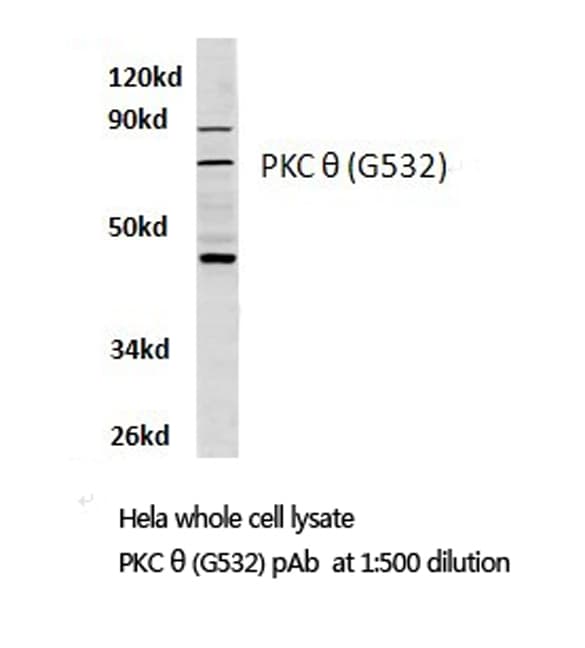 PRKCQ / PKC-Theta Antibody (Gly532)