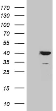 APOL1 / Apolipoprotein L Antibody (aa28-339, clone OTI3D9)