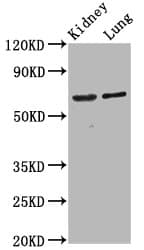 SRRM4 Antibody
