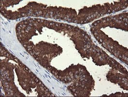 MDM4 / MDMX Antibody (clone OTI4B5)