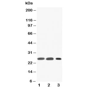 SFTPA1 / Surfactant Protein A Antibody (aa221-236)