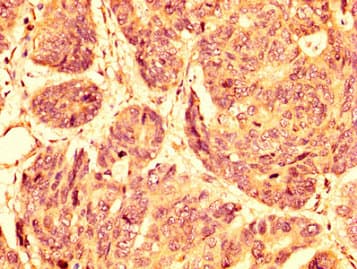 Polyclonal Rabbit anti-Human GPR32 Antibody (IHC, IF, WB)