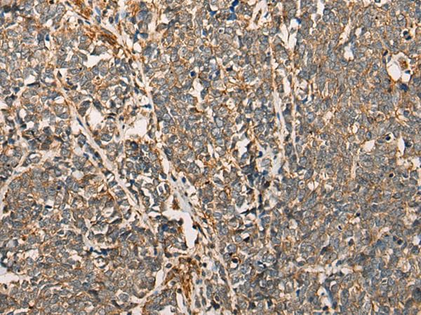 Polyclonal Rabbit anti-Human MRLC2 / MYL12B Antibody (IHC, WB)