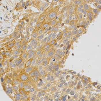 PRKCE / PKC-Epsilon Antibody
