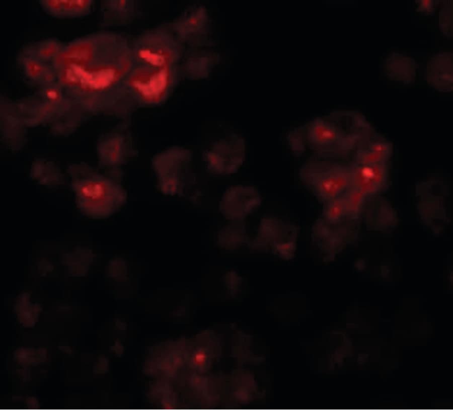 IHC-plus™ Polyclonal Rabbit anti-Human DYRK2 Antibody (IHC, IF, WB)