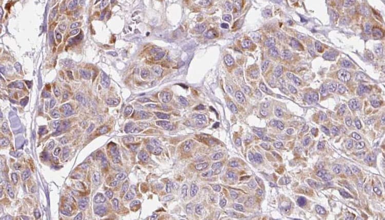 CCL4 / MIP-1 Beta Antibody (aa42-68)