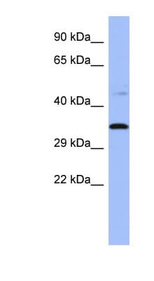 Polyclonal Rabbit anti-Human PYCR1 Antibody (C-Terminus, IHC, WB)