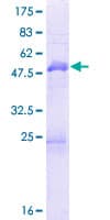 Human MBNL3 Protein (Recombinant GST)