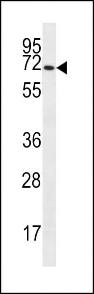 Polyclonal Rabbit anti-Human SLC6A14 Antibody (aa602-631, IHC, WB)
