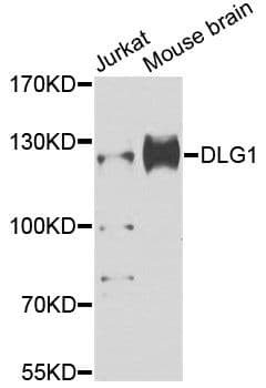 DLG1 / SAP97 Antibody