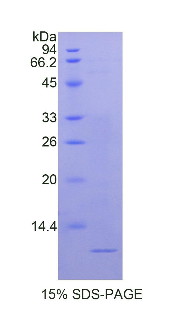 Human NPM1 / NPM / Nucleophosmin Protein (Recombinant His)