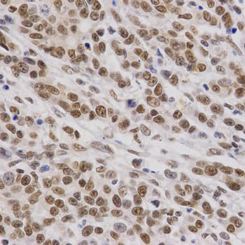 SMARCE1 / BAF57 Antibody