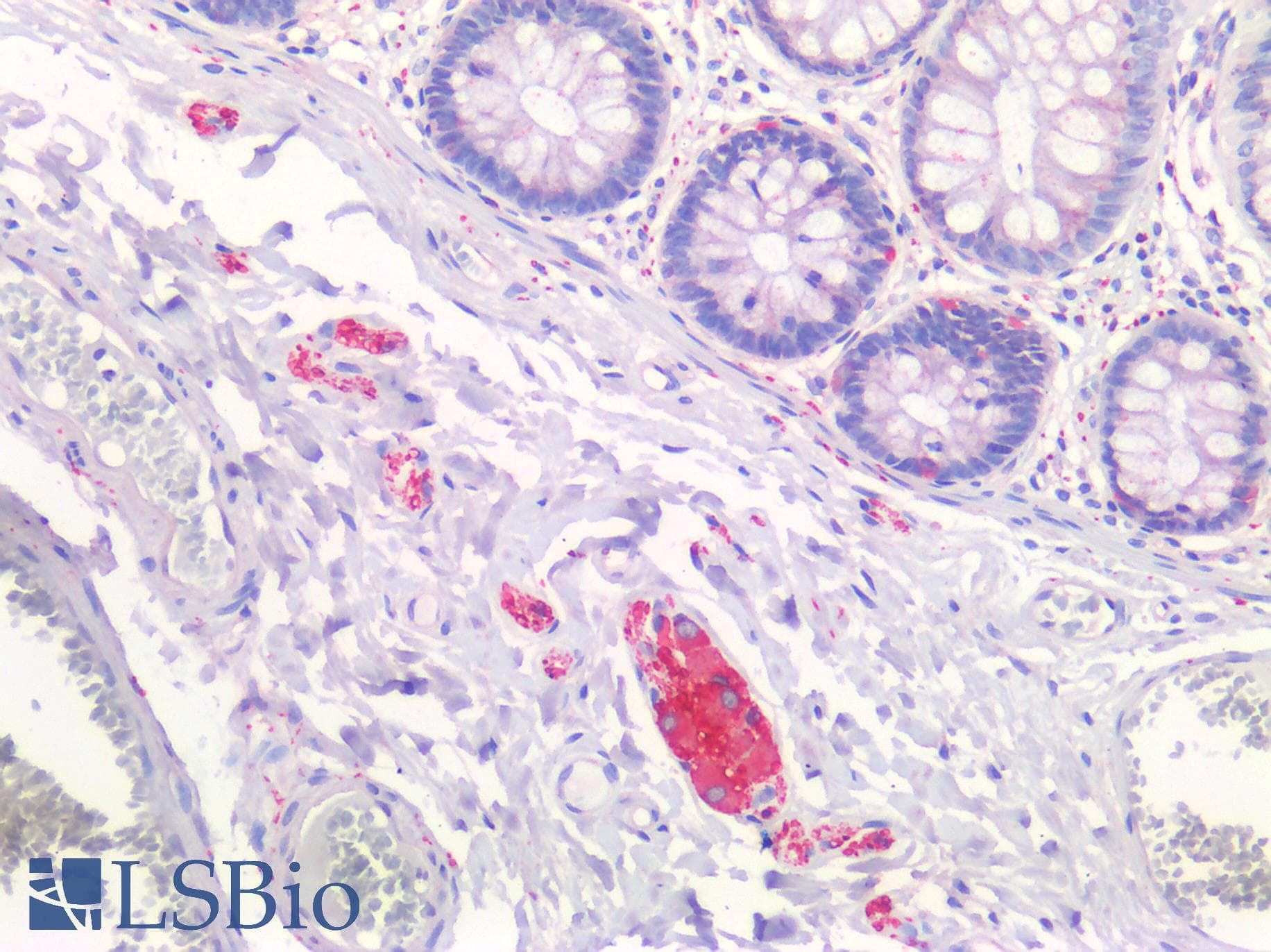 IHC-plus™ TUBB3 / Tubulin Beta 3 Antibody