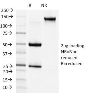CDH2 / N Cadherin Antibody (clone 13A9)