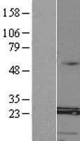 MED8 Protein (Over-Expression Lysate Myc-DDK (Flag))