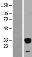 LHPP Protein (Over-Expression Lysate Myc-DDK (Flag))