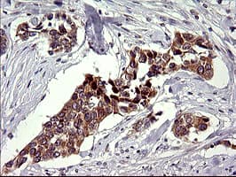 Monoclonal Mouse anti-Human CHAC1 / MGC4504 Antibody (clone OTI1E2, Carrier-free, IHC, IF, WB)