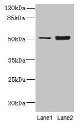 KRT80 / Keratin 80 Antibody