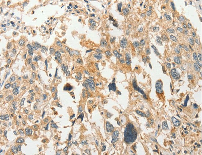 SLC11A2 / DMT1 Antibody