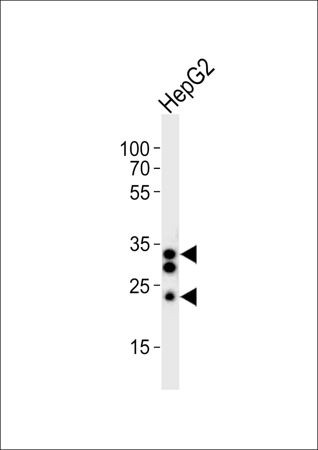SULT1A1 / Sulfotransferase 1A1 Antibody (aa246-279)