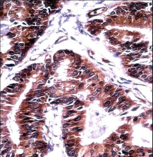 TCEB1 / Elongin C Antibody (aa69-98)