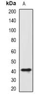ST8SIA4 Antibody