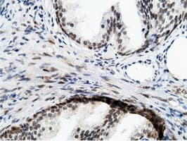 EPM2AIP1 Antibody (clone OTI2G3)