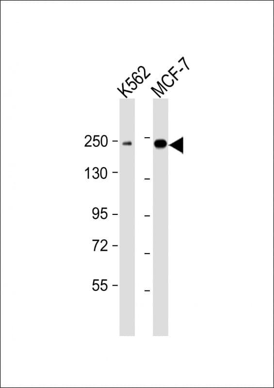XRN1 Antibody (aa1455-a706, clone 1647CT536.85.48)