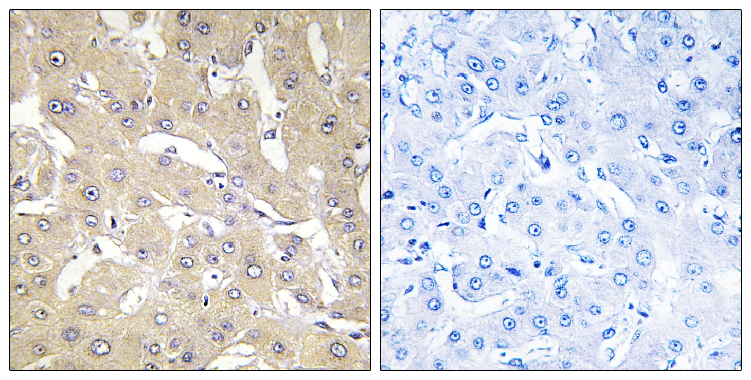 TNFAIP2 Antibody (aa131-180)