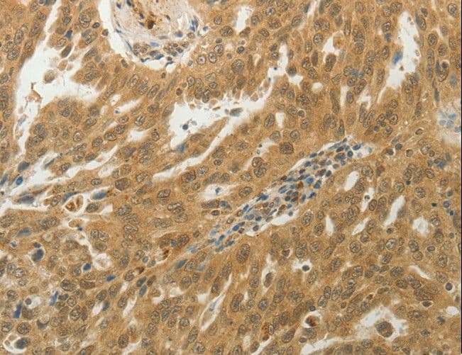 MYSM1 Antibody