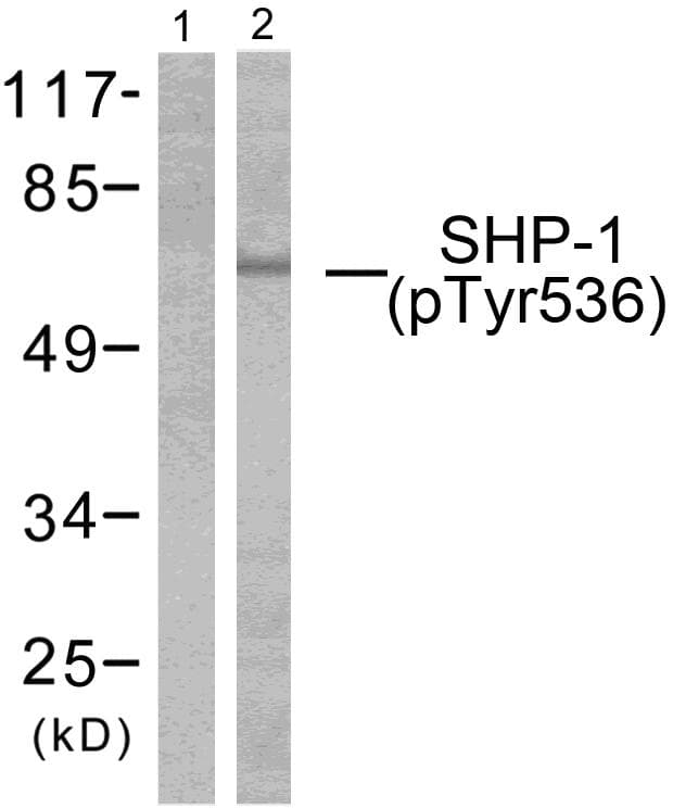PTPN6 / SHP1 Antibody (phospho-Tyr536)