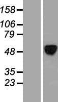 ALX4 Protein (Over-Expression Lysate Myc-DDK (Flag))