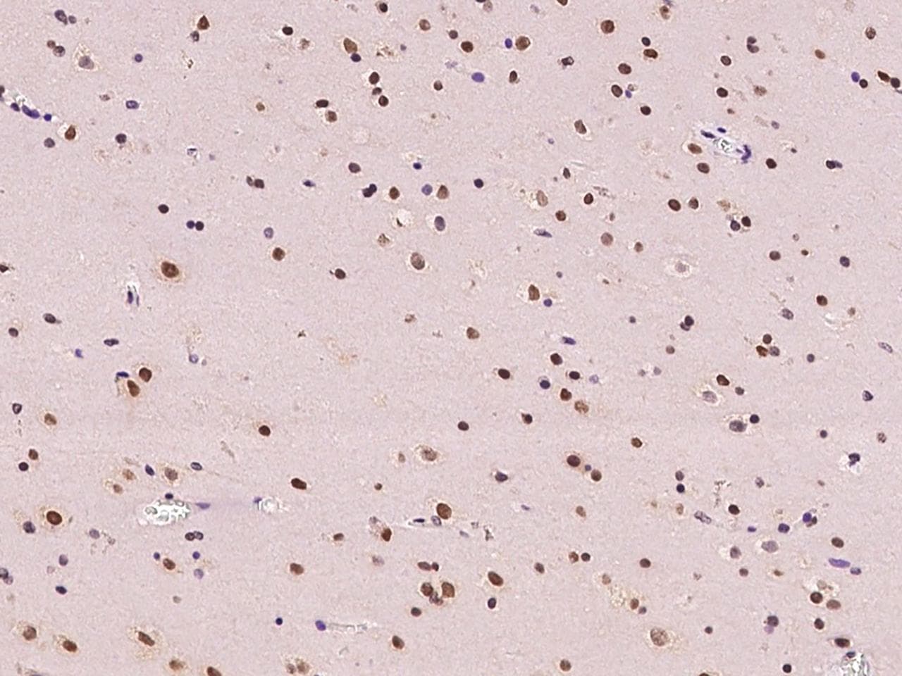 Polyclonal Rabbit anti-Human NR4A2 / NURR1 Antibody (IHC, IF)