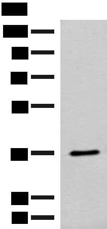 Polyclonal Rabbit anti-Human FAM84A Antibody (IHC, WB)