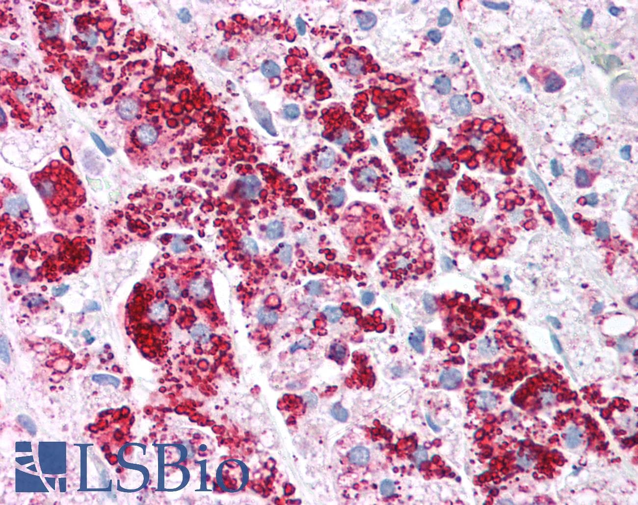IHC-plus™ PLIN3 / M6PRBP1 / TIP47 Antibody (aa350-435)