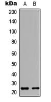 HAND1 Antibody (C-Terminus)