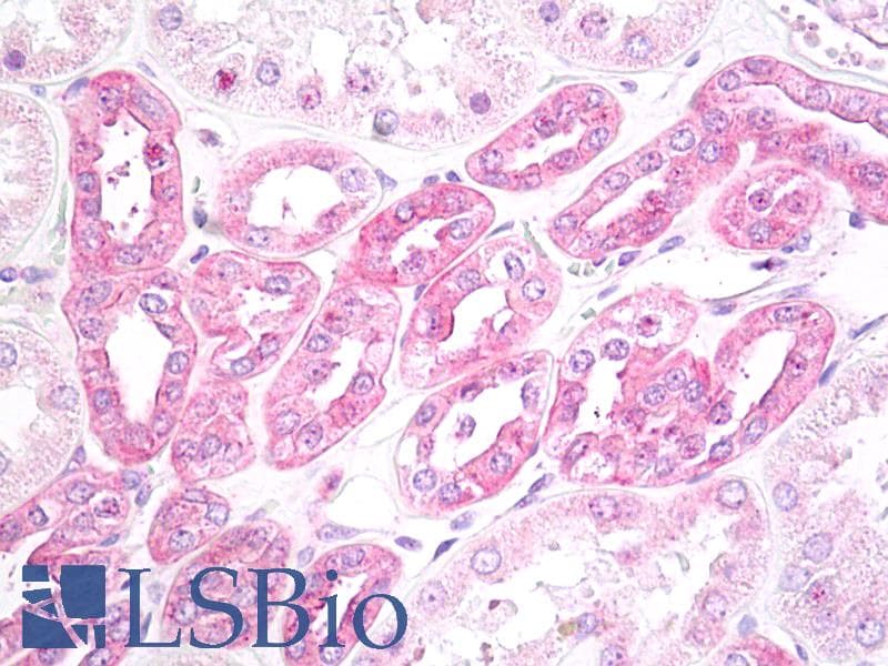 IHC-plus™ TNFSF10 / TRAIL Antibody (aa31-80)