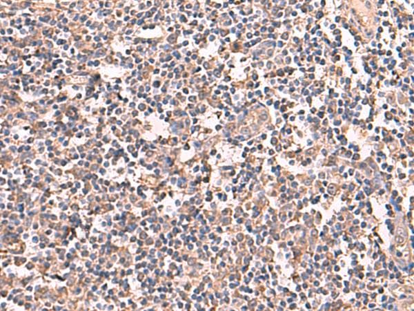 Polyclonal Rabbit anti-Human RIOK1 Antibody (IHC)