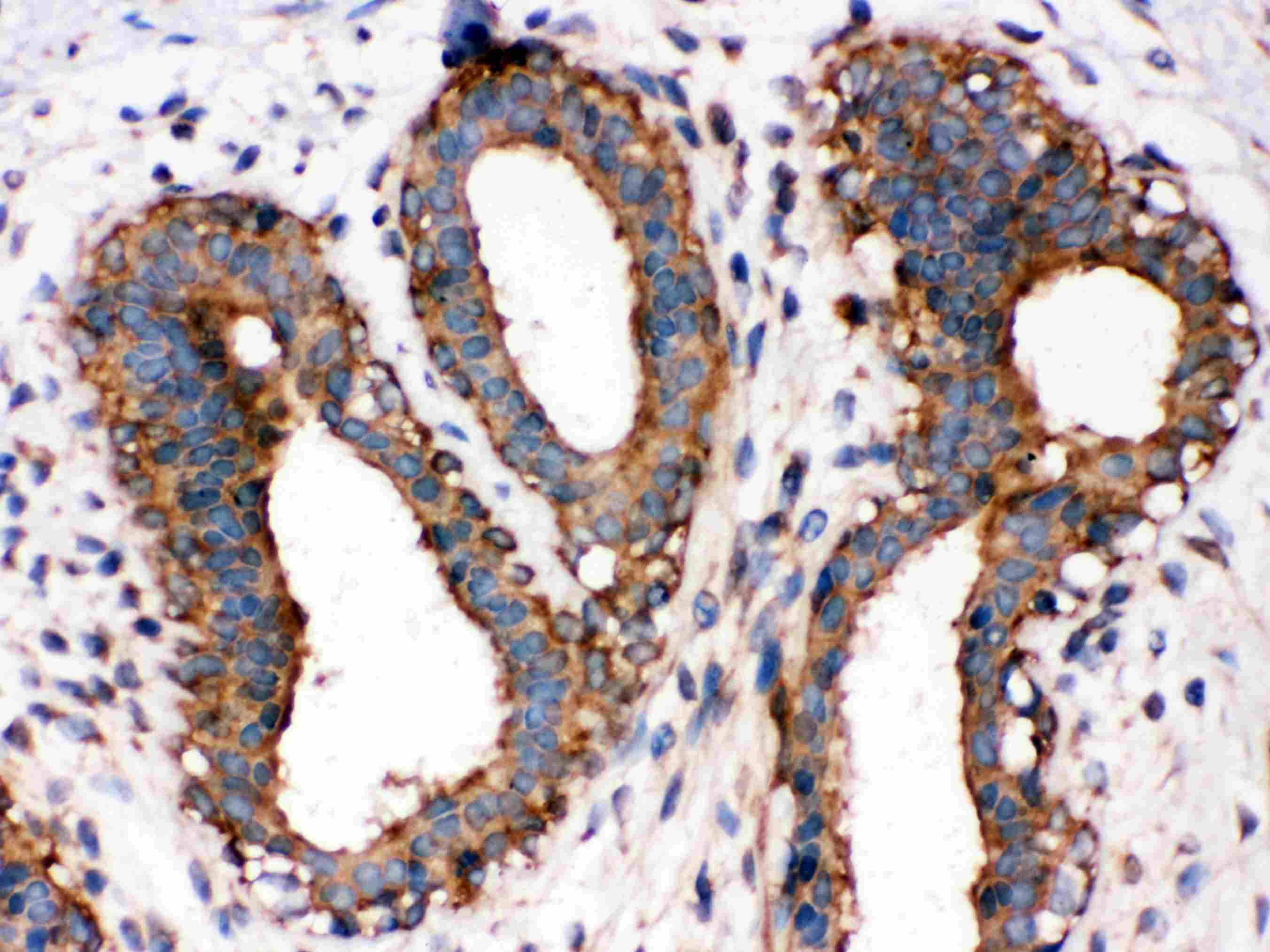 RELA / NFKB p65 Antibody (aa143-158)