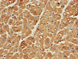 SRR / Serine Racemase Antibody