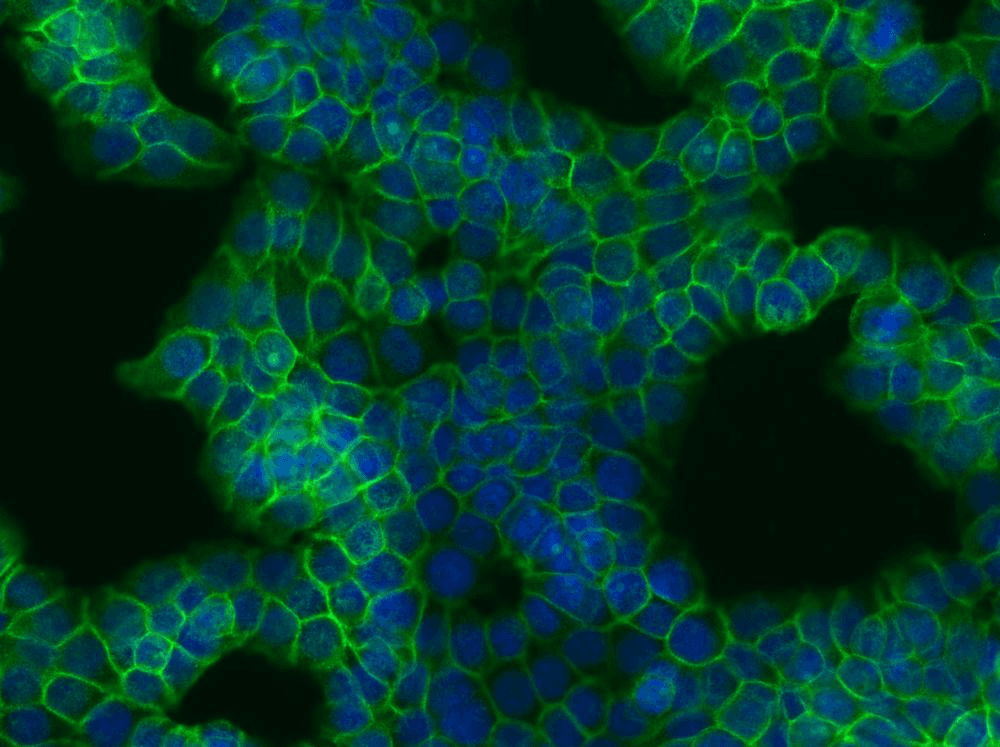 PathPlus™ CTNNB1 / Beta Catenin Antibody (clone EM-22)