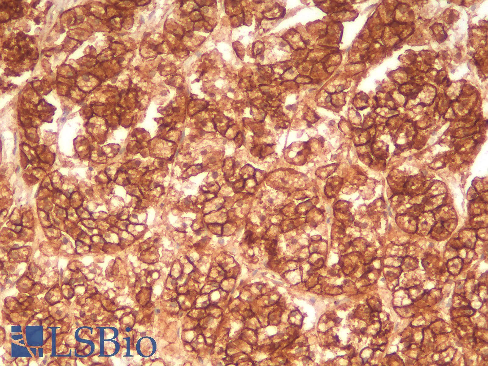 PathPlus™ CTNNB1 / Beta Catenin Antibody (clone rCTNNB1/2173)