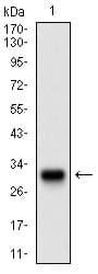 Monoclonal Mouse anti-Human TWIST1 / TWIST Antibody (clone 10E4E6, aa9-74, IHC, IF, WB)