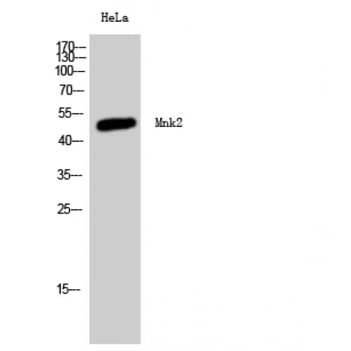 Polyclonal Rabbit anti-Human MKNK2 / MNK2 Antibody (Internal, WB)