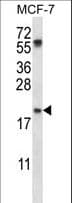 Polyclonal Rabbit anti-Human PYCARD / ASC / TMS1 Antibody (aa129-158, WB)