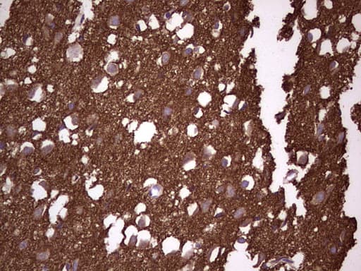 NCAM / CD56 Antibody (aa20-718, clone OTI2B9)