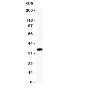 CCL17 / TARC Antibody (aa34-103)