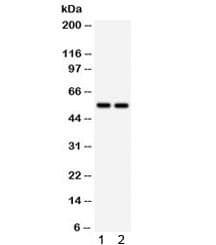 Polyclonal Rabbit anti-Human ALDH2 Antibody (IHC, WB)