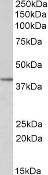 IHC-plus™ SFRP4 Antibody (aa239-253)