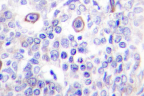 CD83 Antibody (Pro130)